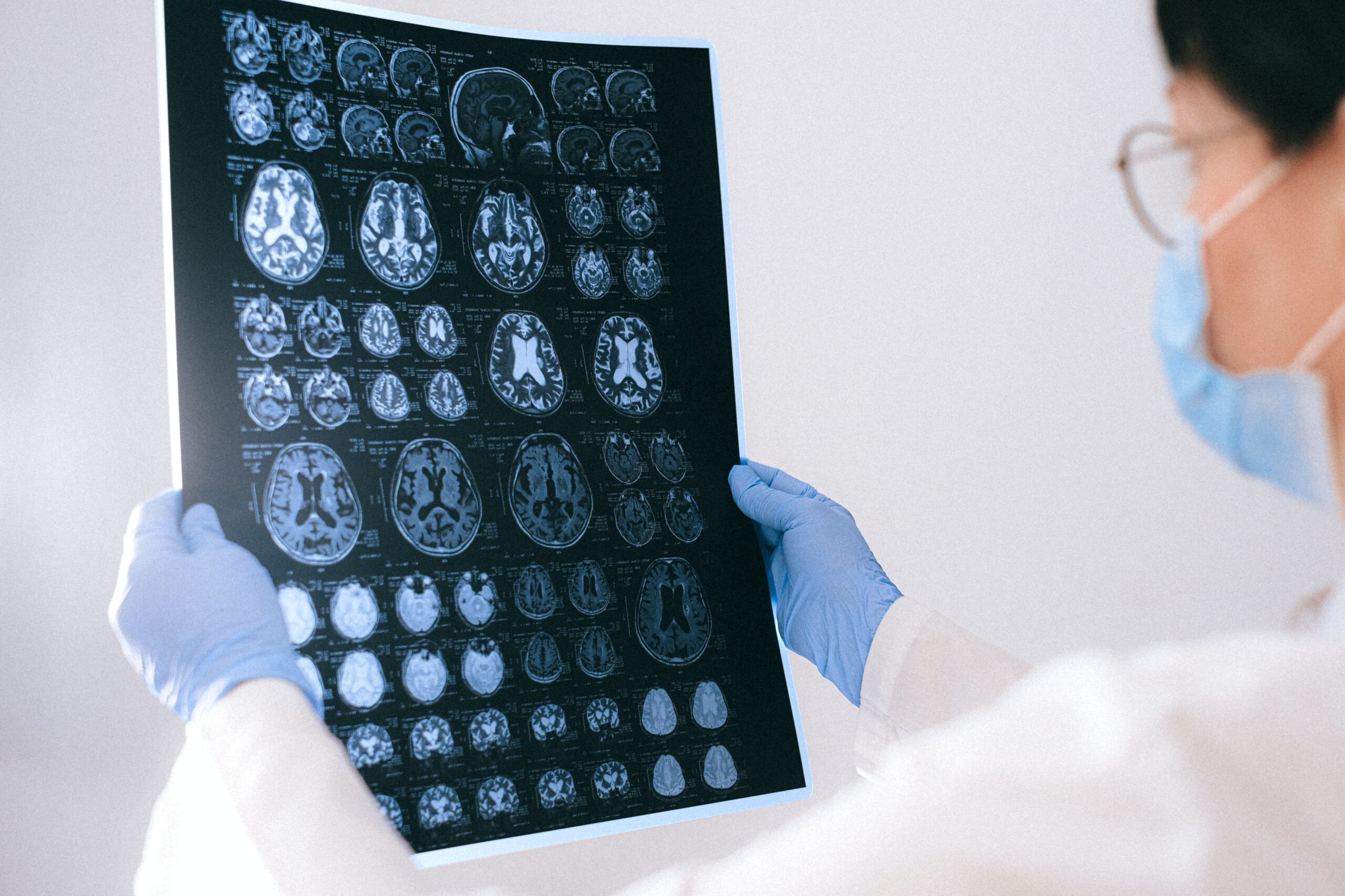Doctor looking at brain MRI scans.